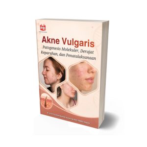 AKNE VULGARIS Patogenesis Molekuler, Derajat Keparahan, dan Penatalaksanaan
